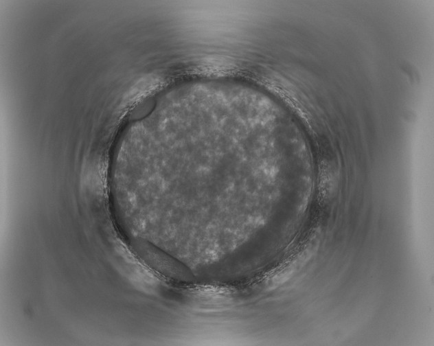 X0000111450585200908031415