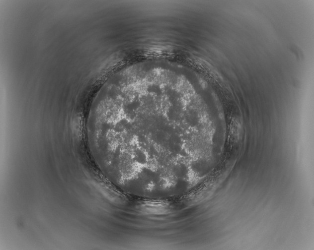 X0000111450659200908031415