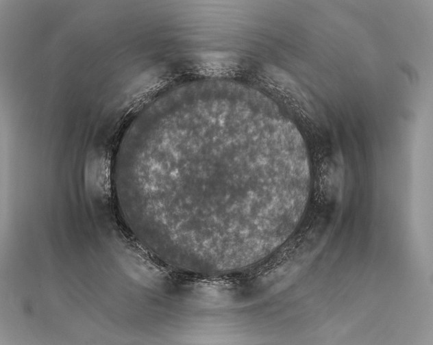 X0000111450696200908031414