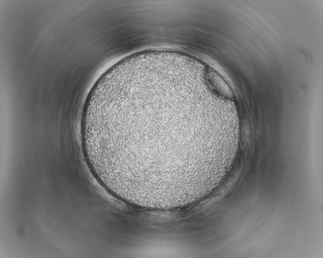 X0000111450959200908031411