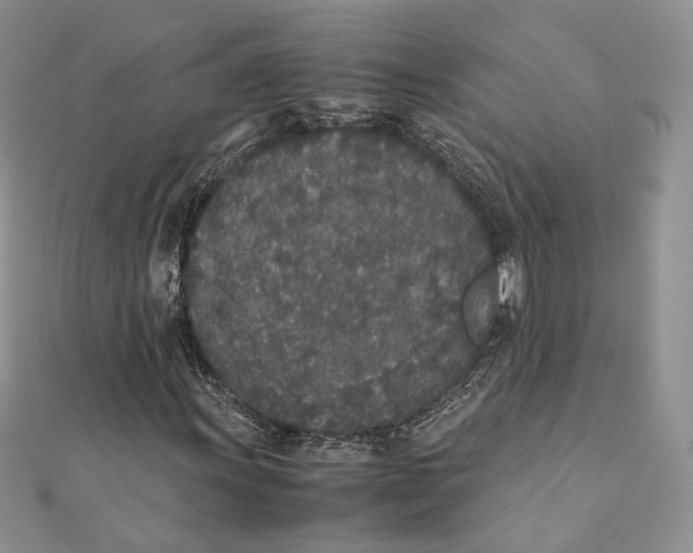 X0000111451011200908031409