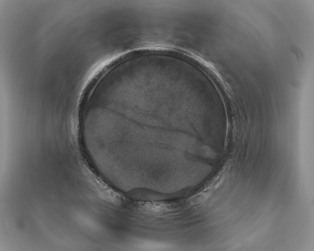 X0000111451319200908031405