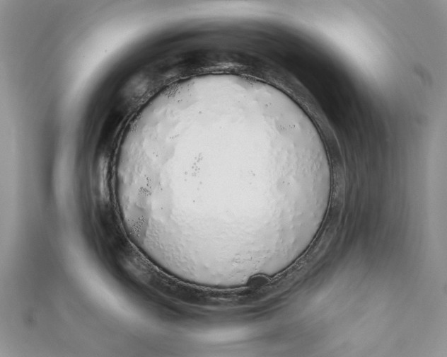 X0000111451439200908031404