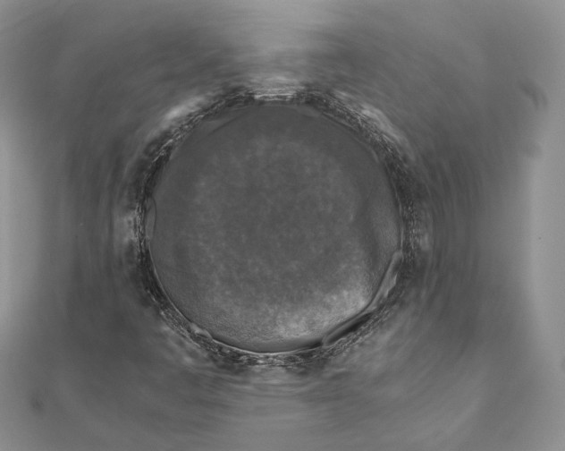 X0000111451445200908031403