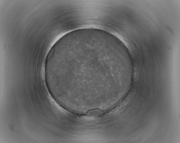 X0000111451468200908031403