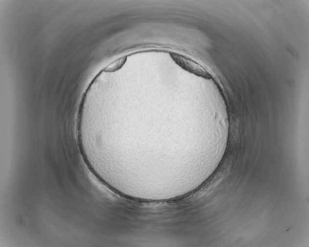 X0000111451535200908031403