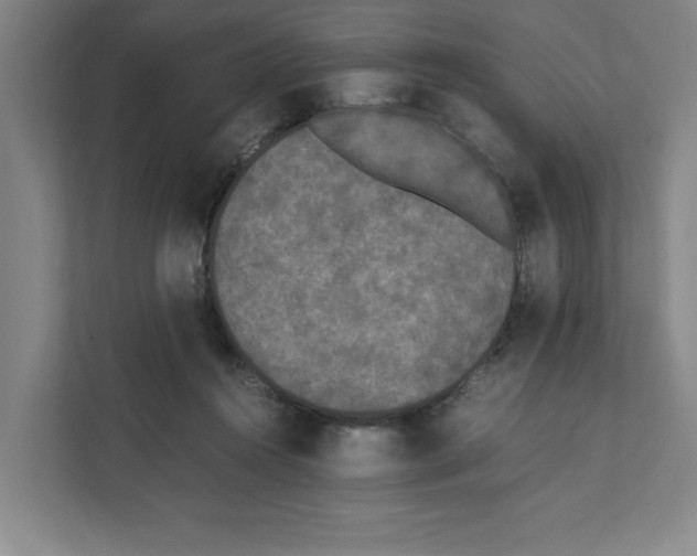 X0000111450360200908101039