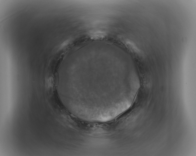 X0000111451445200908101025