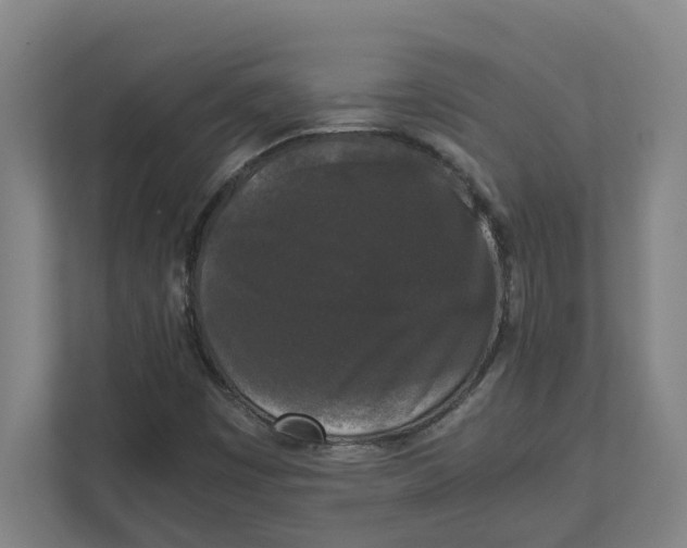 X0000111451449200908101025
