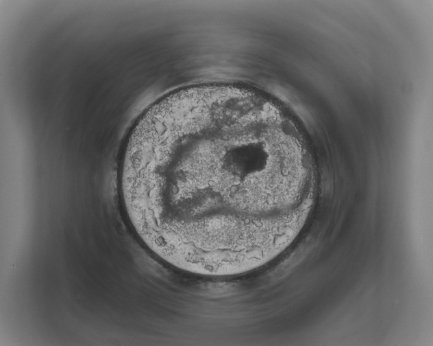 X0000111451459200908101025