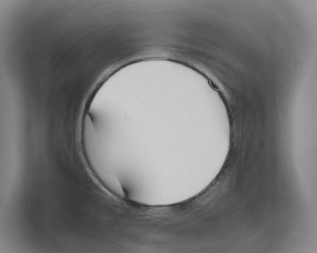 X0000111451477200908101025