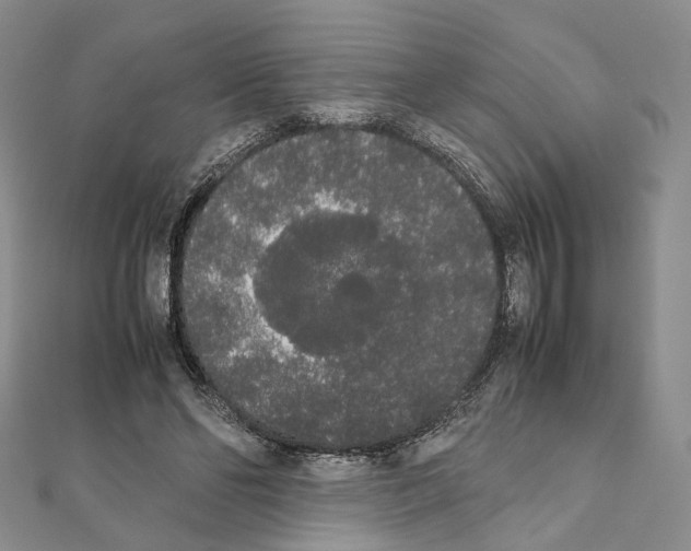 X0000111450494200908241209