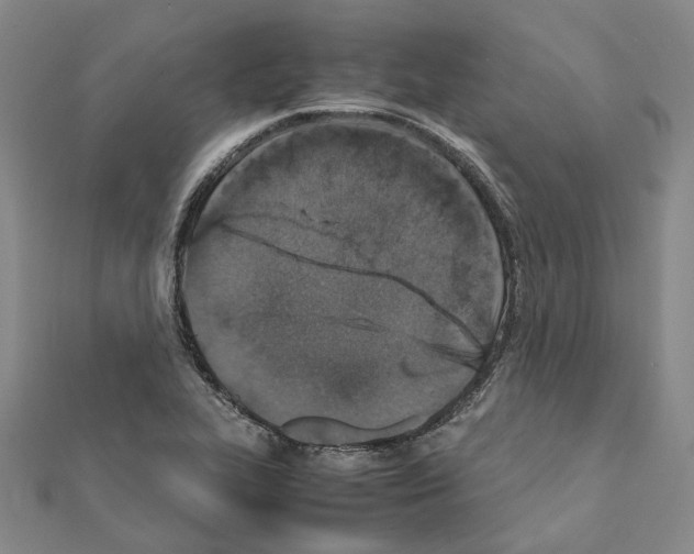 X0000111451319200908241157