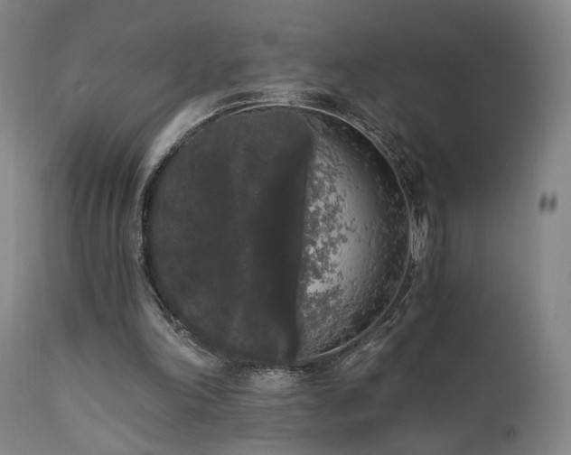X0000111460198200907131503