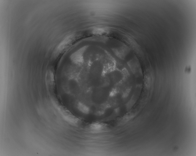 X0000111460375200907131501