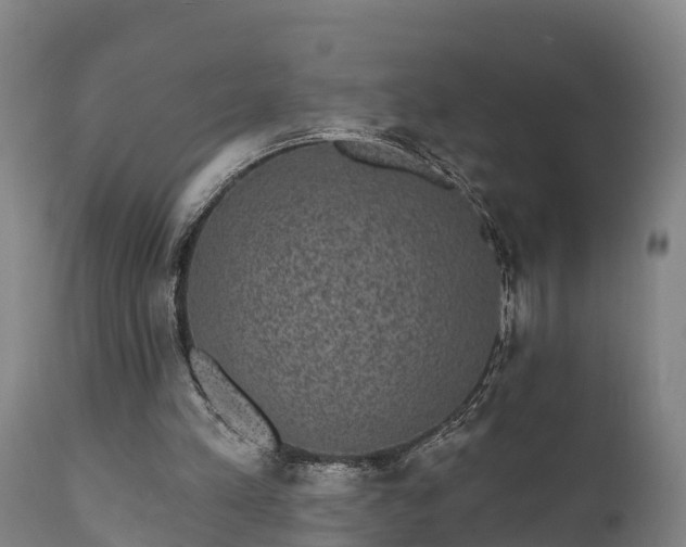 X0000111460197200907201120