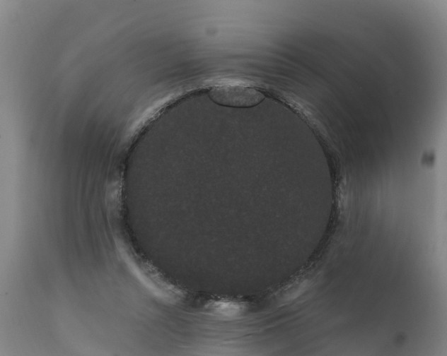 X0000111460352200907201118