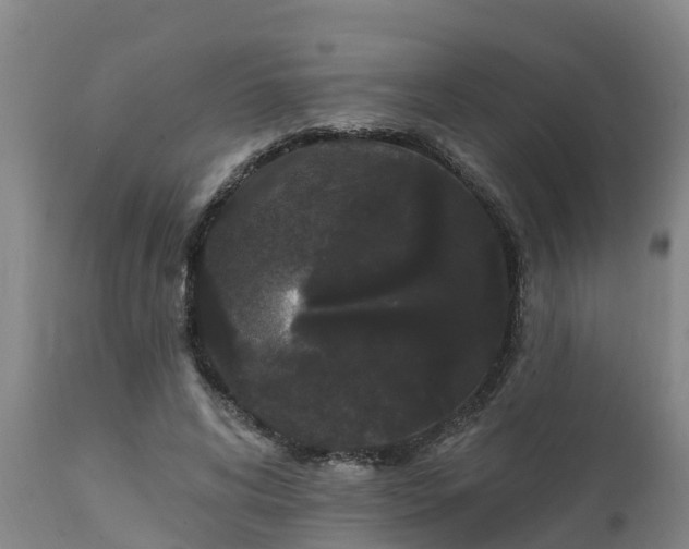 X0000111460592200907201115