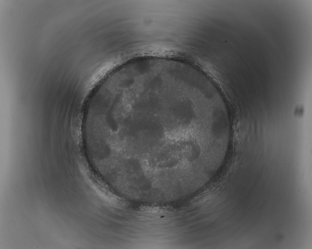 X0000111460679200907201114