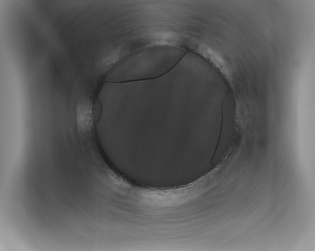 X0000111460017200908031349
