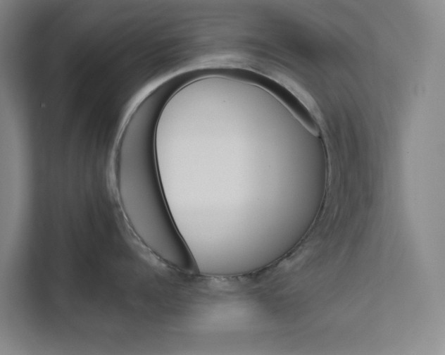 X0000111460960200908031337