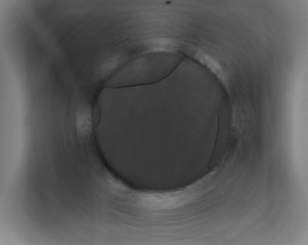 X0000111460017200908101104