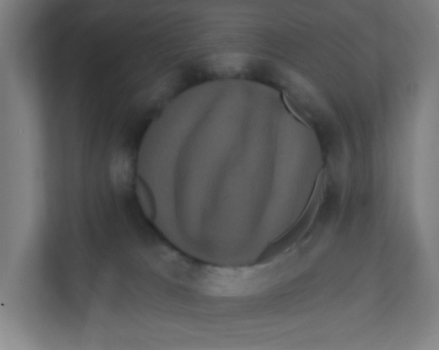 X0000111460037200908101103