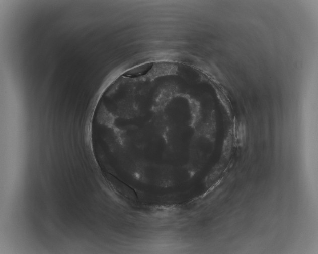 X0000111460099200908101102