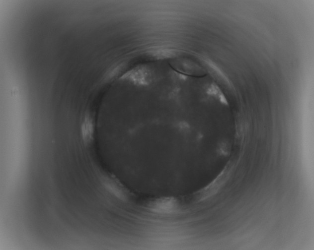 X0000111460124200908101102