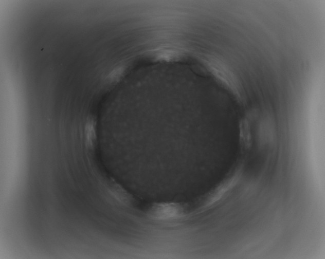 X0000111460127200908101102