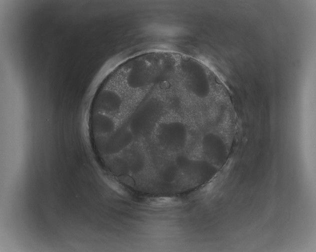 X0000111460151200908101101