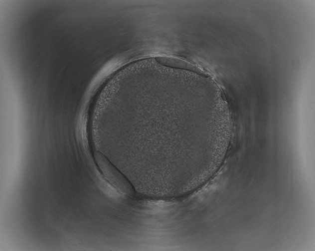 X0000111460197200908101101