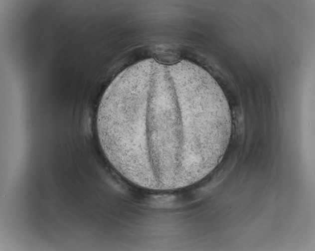 X0000111460266200908101100