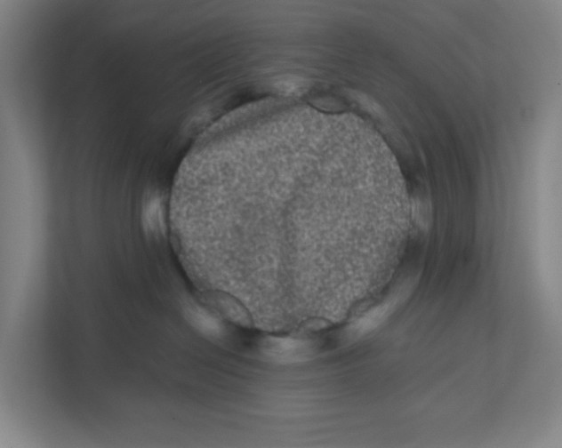 X0000111460286200908101100