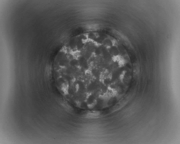 X0000111460369200908101059