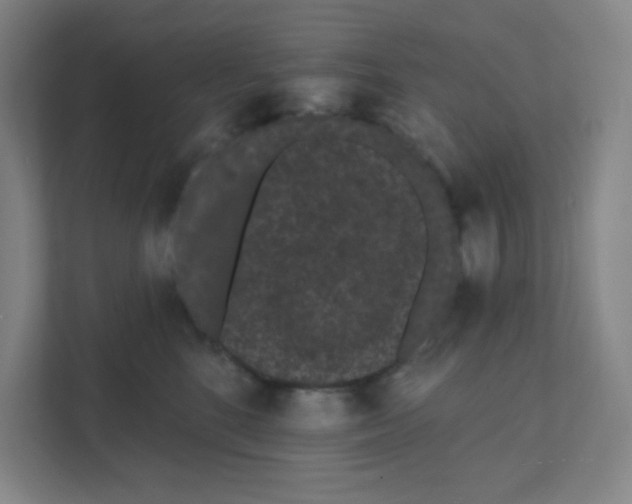 X0000111460520200908101057