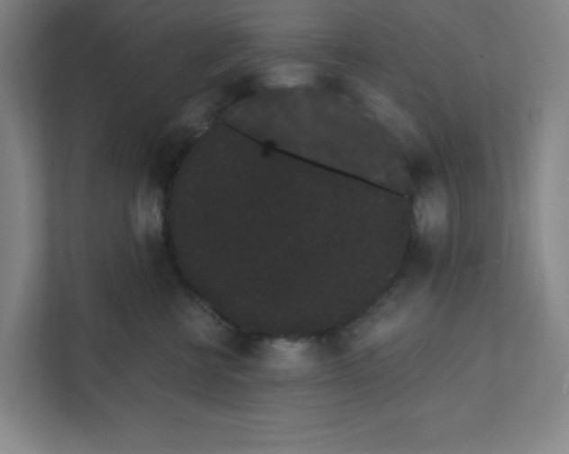 X0000111460570200908101057