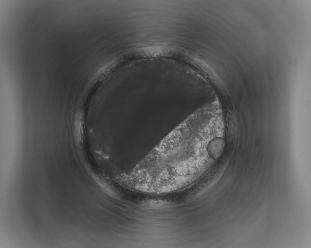X0000111460590200908101056