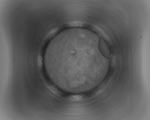 X0000111460692200908101055