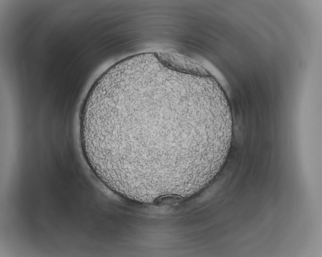 X0000111461096200908101049