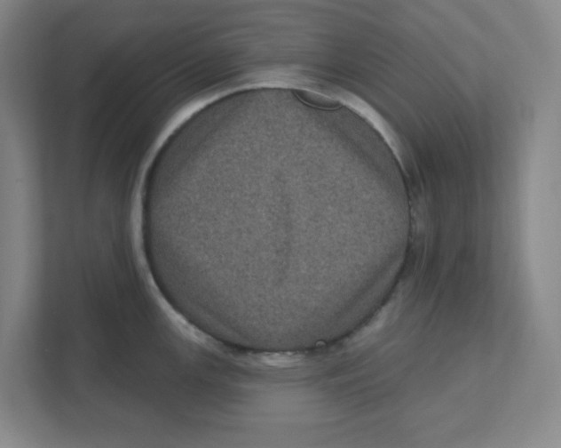X0000111461147200908101049