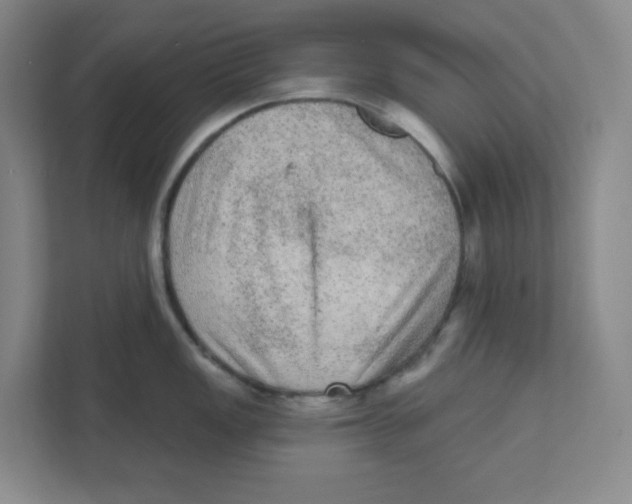 X0000111461149200908101049