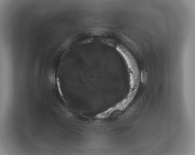 X0000111461155200908101049
