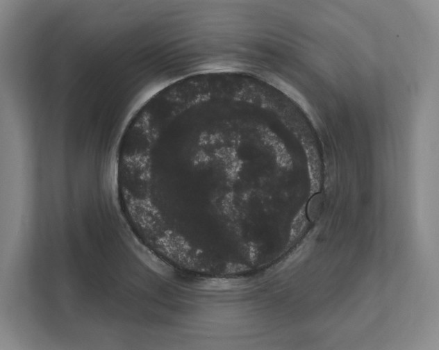X0000111461179200908101048