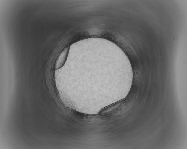 X0000111461249200908101047
