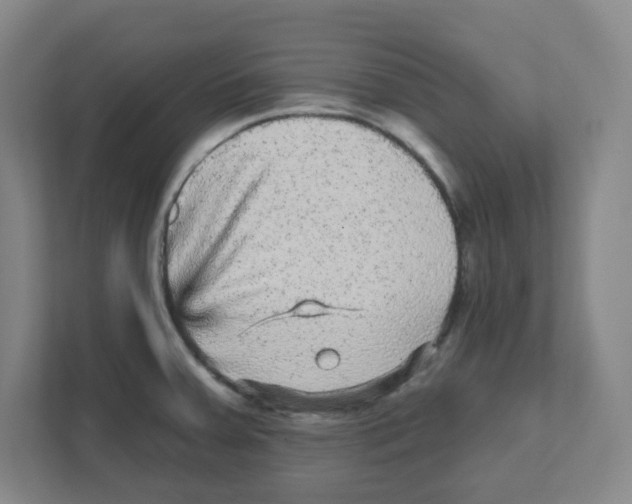 X0000111461379200908101046