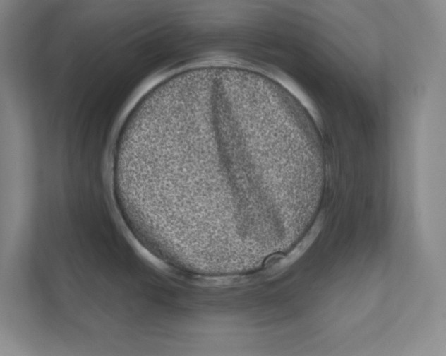 X0000111461438200908101046