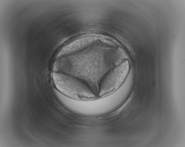 X0000111461449200908101045
