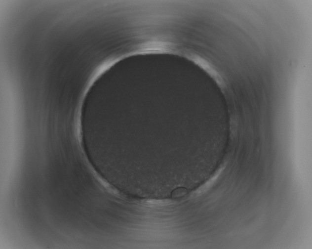 X0000111461469200908101045