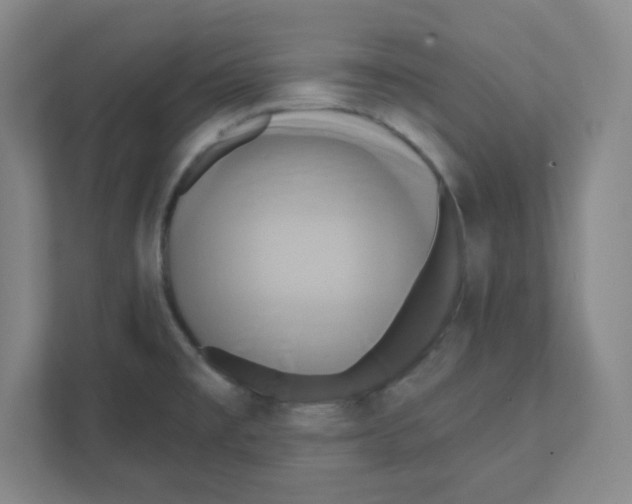 X0000111461477200908101044